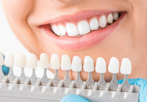 Cosmetic Dentist Summerlin